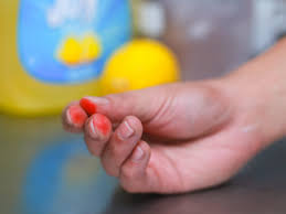 Gıda Boyası Elden Nasıl Çıkar?